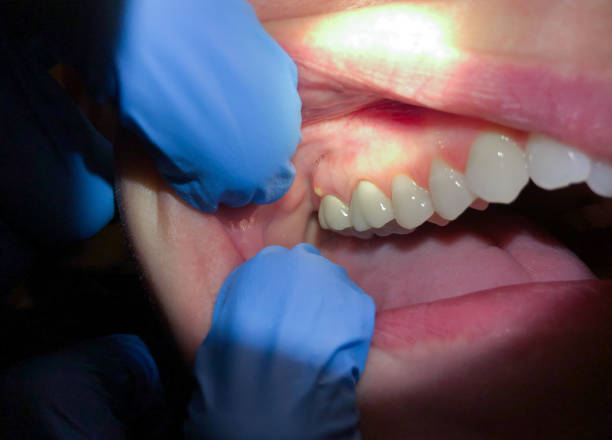 Best Emergency Cosmetic Dentistry in Harristown, IL