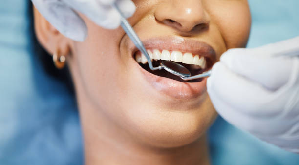 Best Emergency Dentist for Lost Fillings or Crowns in Harristown, IL